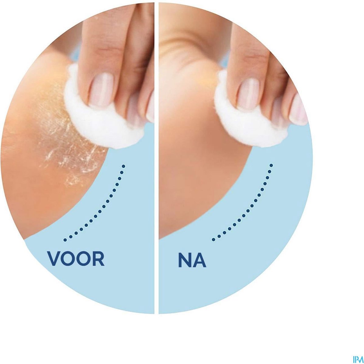 Scholl Velvet Smooth - Elektrische Eeltvijl - Blauw - 1 Stuk