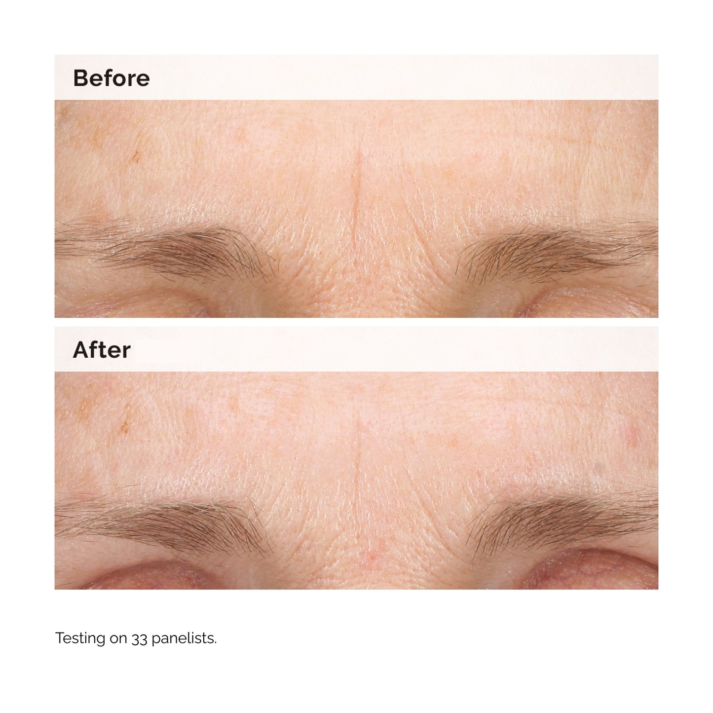 The Ordinary Retinal 0.2% Emulsion Serum