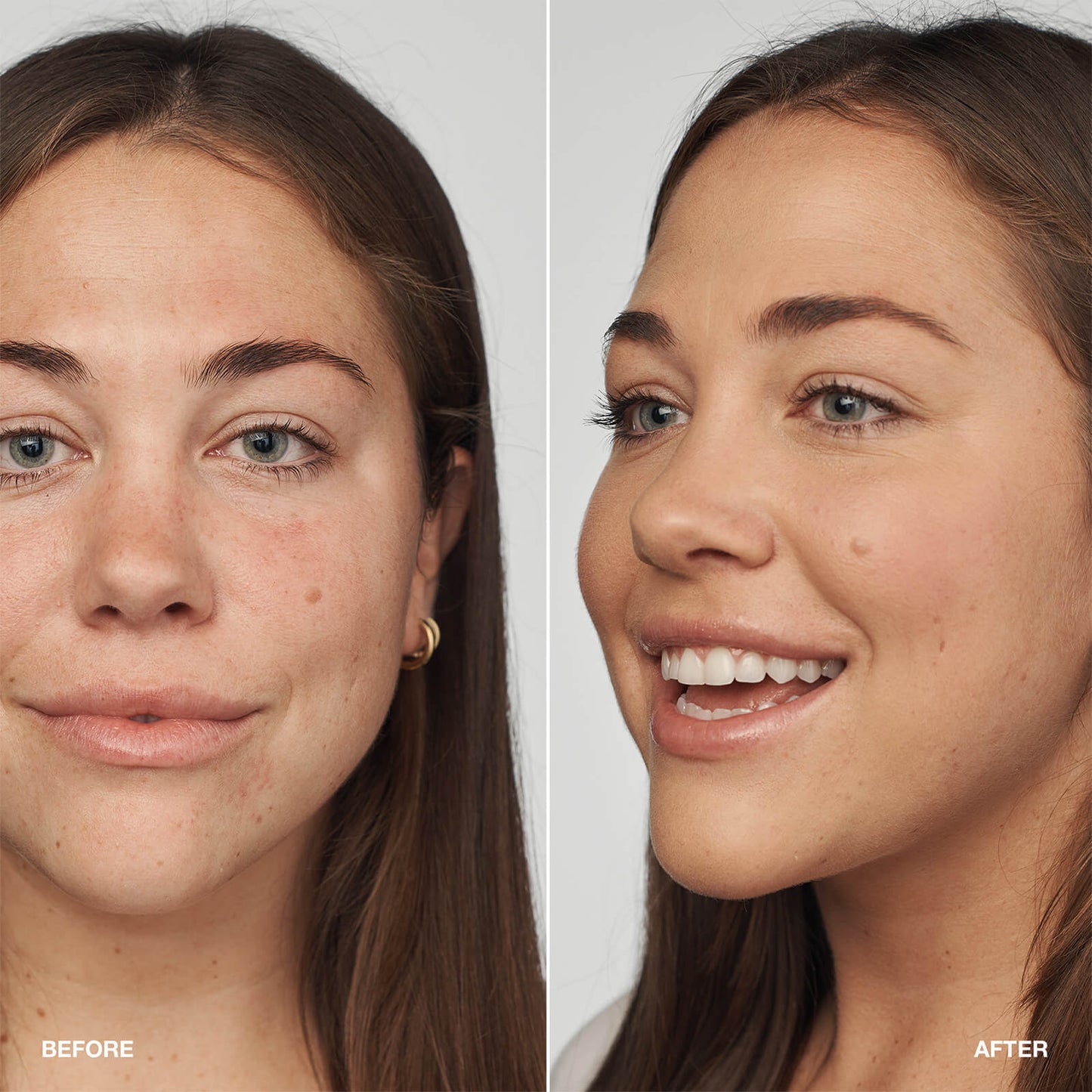 Clinique Even Better Clinical Serum Foundation SPF20 30ml (Various Shades) - Buff