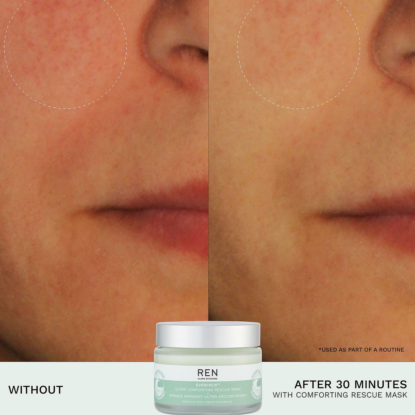 REN Clean Skincare Ultra Comforting Rescue Masker 50 ml