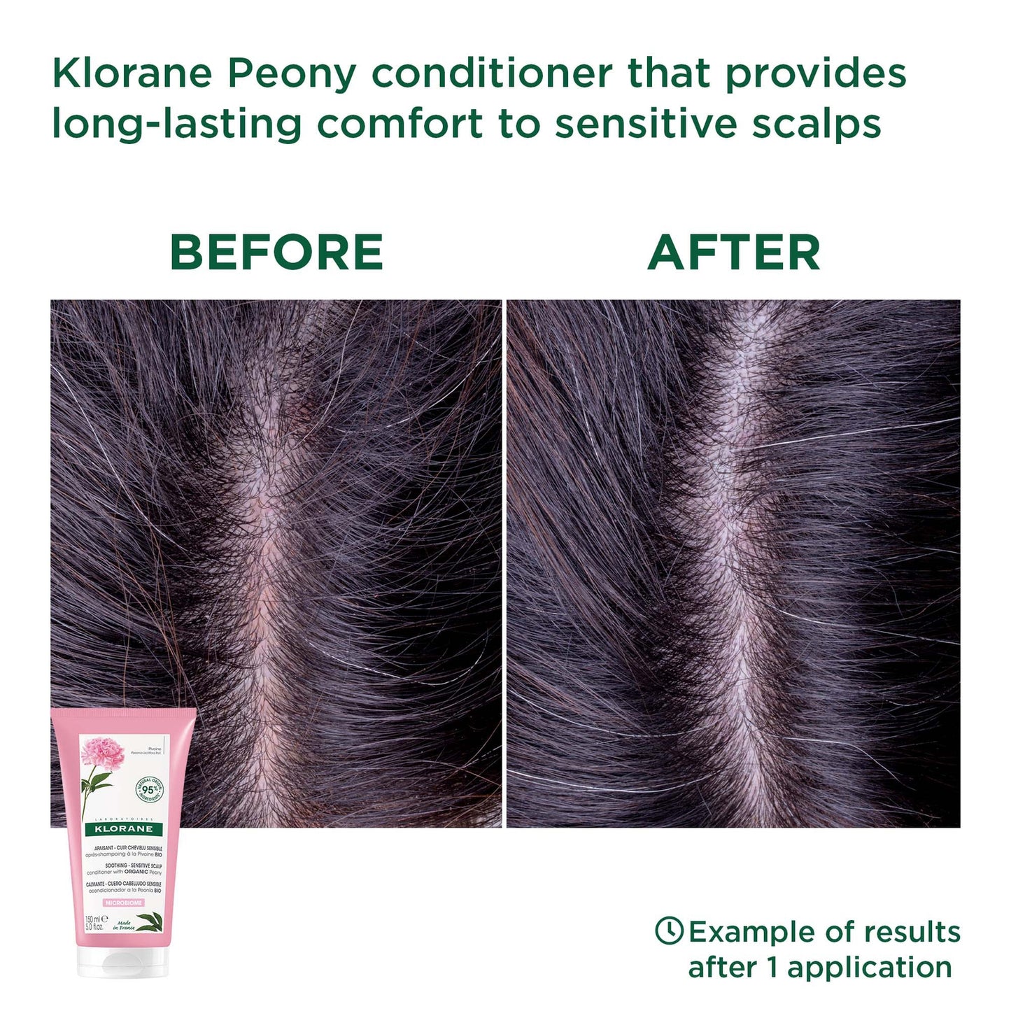 KLORANE Soothing Conditioner with Organic Peony for Dry, Sensitive Scalps 150ml