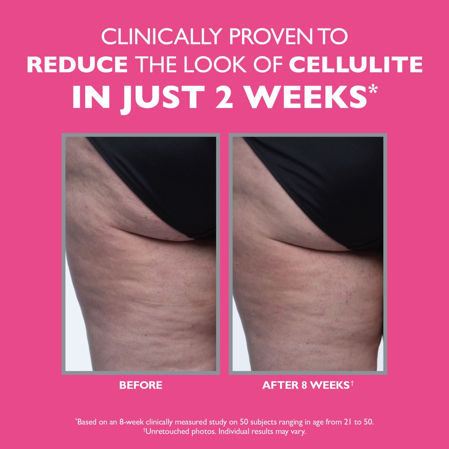 Peter Thomas Roth FIRMx® Strakke & Toned Cellulitisbehandeling