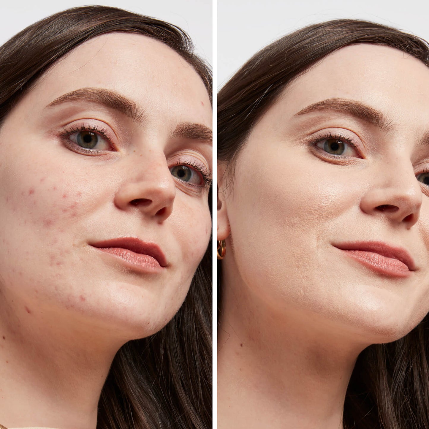 IT Cosmetics BYE BYE DARK SPOTS™ Concealer + Serum
