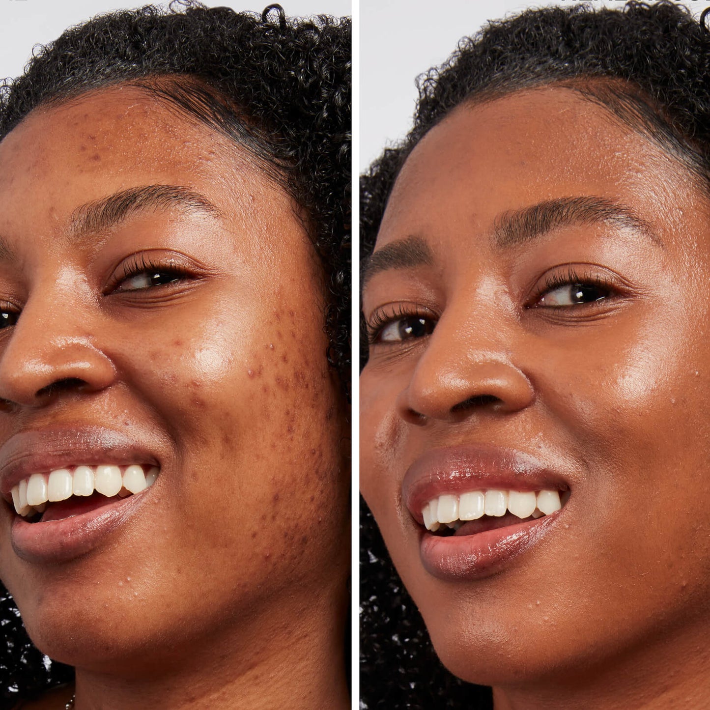 IT Cosmetics BYE BYE DARK SPOTS™ Concealer + Serum