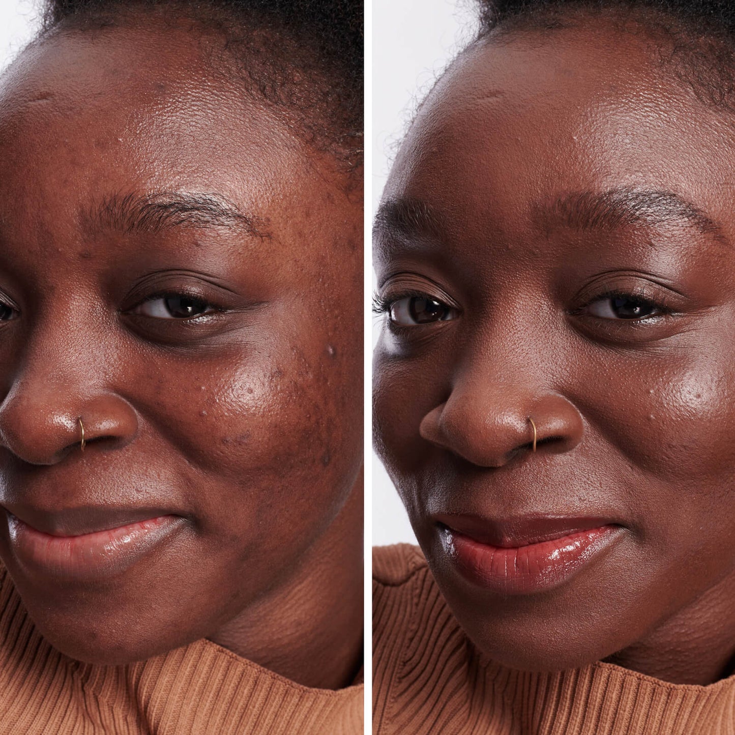 IT Cosmetics BYE BYE DARK SPOTS™ Concealer + Serum