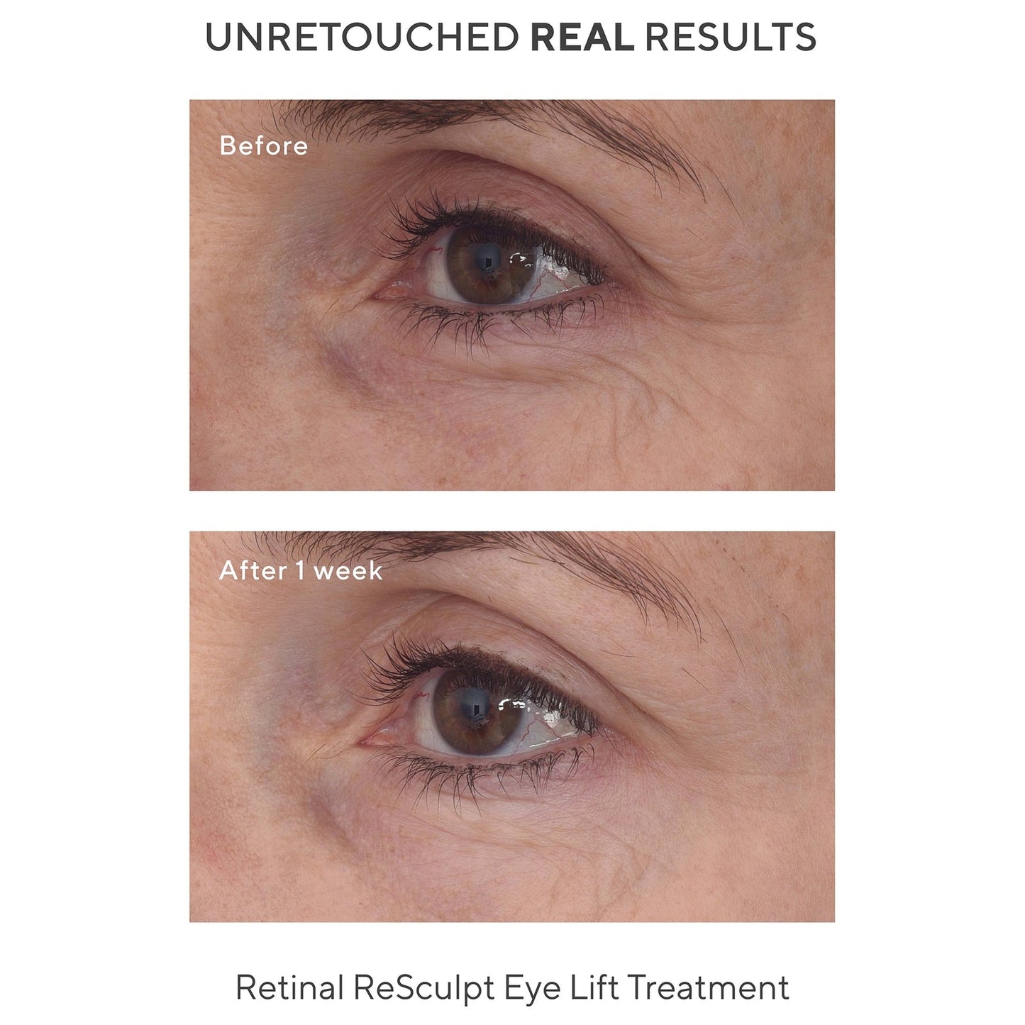 Murad Retinal ReSculpt Eye Treatment 30ml