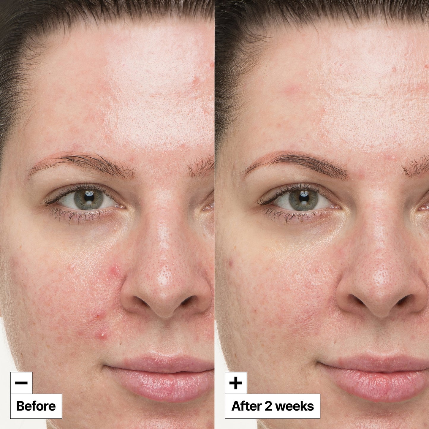 Dr. Jart+ Cicapair™ So Soothing Treatment