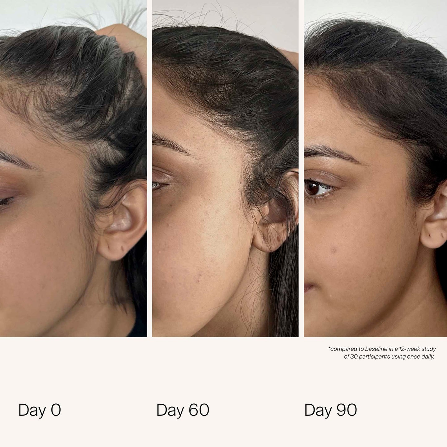 Living Proof scalp care Density Serum