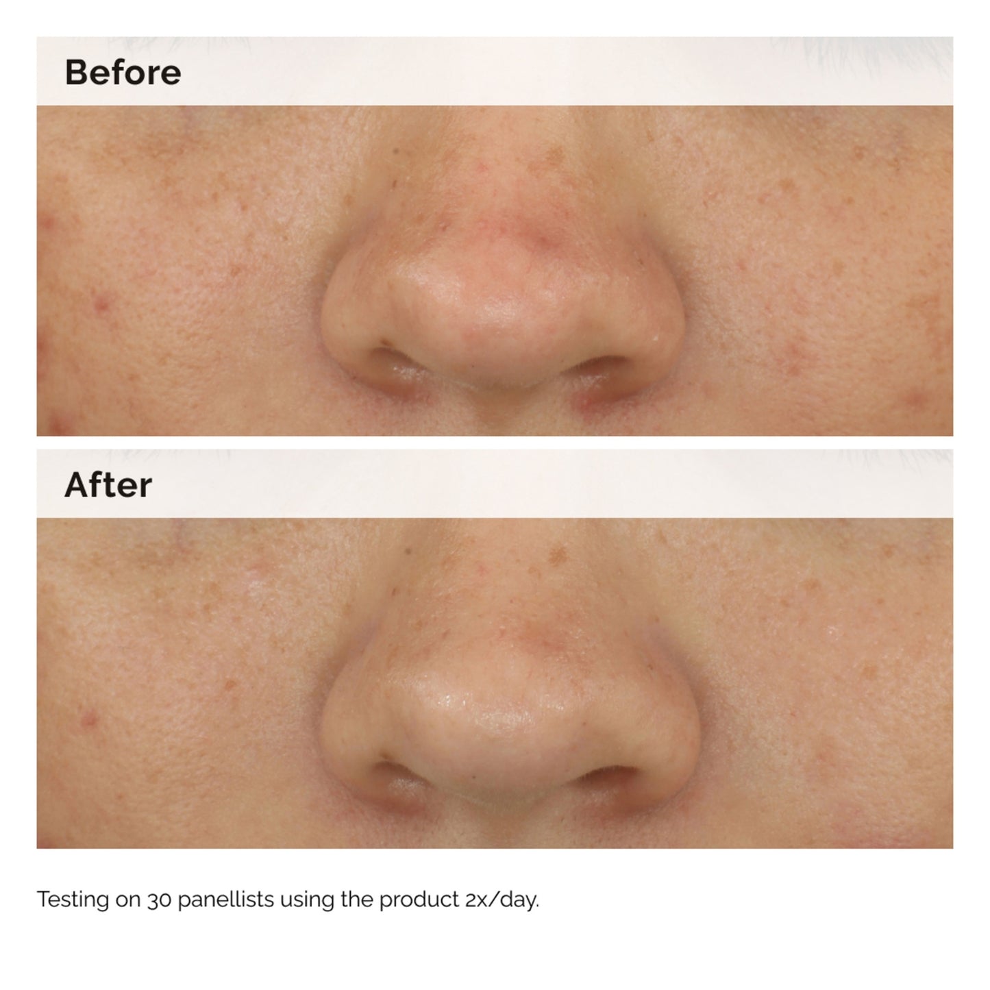 The Ordinary Balancing & Clarifying