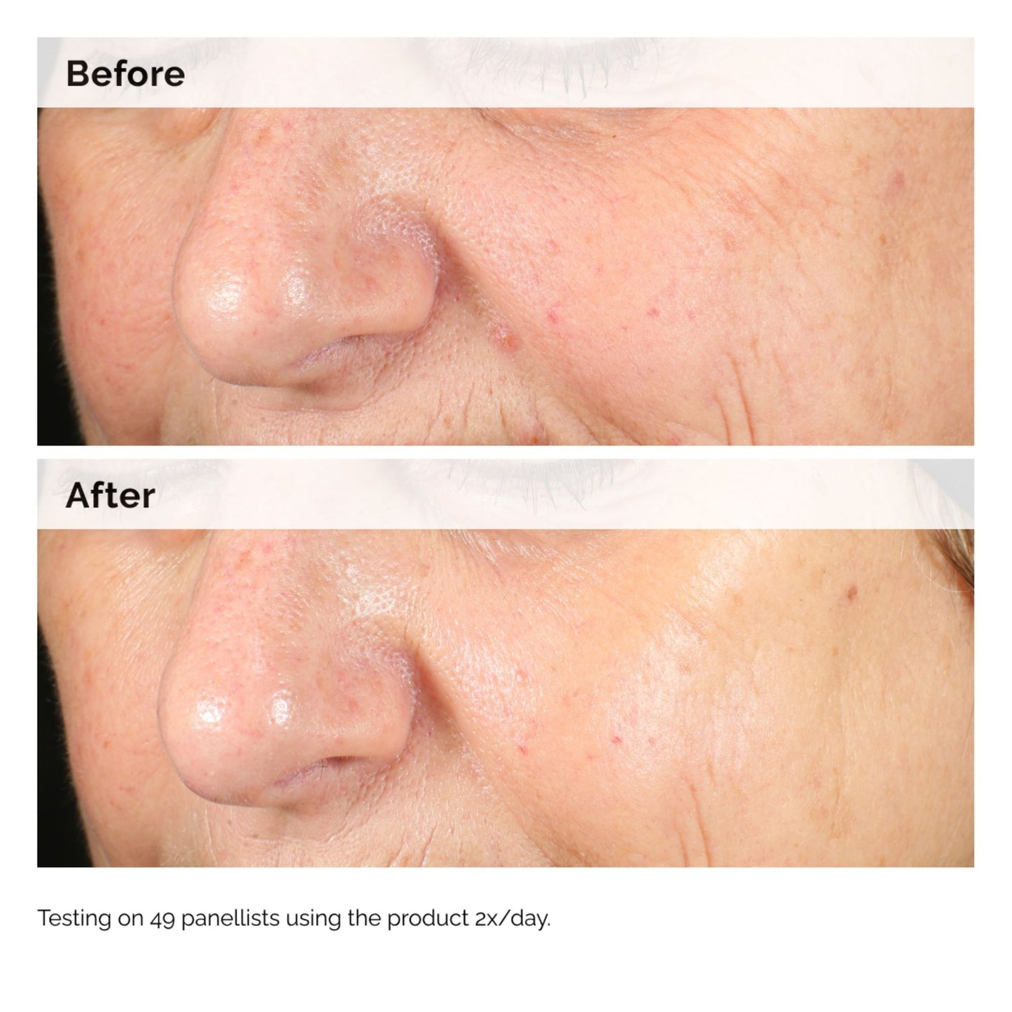 The Ordinary Alpha Arbutine 2% + HA