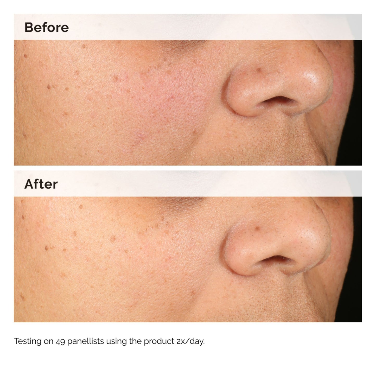 The Ordinary Alpha Arbutine 2% + HA