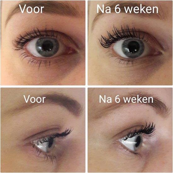 Dr. Massing LongLashes Serum Wimperserum 3 ml